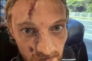 开云-爱游戏-太拼了！英格兰第五级别联赛前锋与门将拼抢，面部被严重划伤